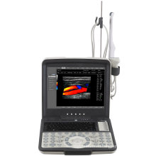 Full Digital Palm Size Black and White Ultrasound Scanner for Veterinary Use